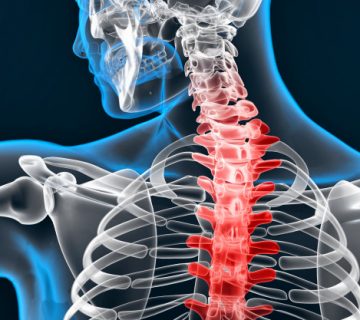 فییوتراپی ورزشی در اصفهان