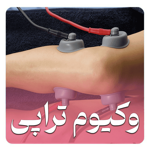فیزیوتراپ خوب در اصفهان بهترین فیزیوتراپی اصفهان-فیزیوتراپیست خوب اصفهان-فیزیوتراپی تخصصی اصفهان-فیزیوتراپی با بیمه در اصفهان-فیزیوتراپی ورزشی اصفهان-فیزیوتراپی در منزل اصفهان-مرکز فیزیوتراپی مجهز اصفهان-فیزیوتراپی دراصفهان،- کلینیک فیزیوتراپی اصفهان،- فیزیوتراپ خوب در اصفهان بهترین فیزیوتراپیست اصفهان-دکتر فیزیوتراپی اصفهان-متخصص فیزیوتراپی اصفهان-فیزیوتراپیست خوب اصفهان-بهترین کلینیک فیزیوتراپی اصفهان-فیزیوتراپ باتجربه اصفهان-فیزیوتراپیست ورزشی اصفهان-متخصص دیسک کمر اصفهان-فیزیوتراپ کودکان اصفهان-فیزیوتراپیست زنان اصفهان-دکتر فیزیوتراپی ستون فقرات-فیزیوتراپ در منزل اصفهان-بهترین مرکز توانبخشی اصفهان-فیزیوتراپیست دستی اصفهان-متخصص درد اصفهان-فیزیوتراپ سالمندان اصفهان-آدرس فیزیوتراپی خوب اصفهان-نوبت فیزیوتراپی اصفهان-قیمت فیزیوتراپی اصفهان-فیزیوتراپیست حرفه‌ای اصفهان-فیزیوتراپی در منزل اصفهان-فیزیوتراپیست درمنزل اصفهان-فیزیوتراپ در منزل اصفهان-"بهترین فیزیوتراپیست برای دیسک کمر در اصفهان"-"فیزیوتراپ خوب و ارزان در اصفهان"-"آدرس بهترین کلینیک فیزیوتراپی در اصفهان"-"فیزیوتراپیست متخصص آسیب‌های ورزشی اصفهان"-"بهترین دکتر فیزیوتراپی کودکان در اصفهان"-فیزیوتراپ خوب چهارباغ اصفهان-بهترین فیزیوتراپیست آمادگاه-فیزیوتراپ ملک شهر اصفهان-متخصص فیزیوتراپی نظر اصفهان-فیزیوتراپیست احمدآباد اصفهان-متخصص فیزیوتراپی اصفهان-بهترین فیزیوتراپ اصفهان- فیزیوتراپیست معتبر اصفهان- فیزیوتراپ مجرب اصفهان- فیزیوتراپیست تخصصی اصفهان-بهترین کلینیک فیزیوتراپی اصفهان- فیزیوتراپ ورزشی اصفهان-فیزیوتراپیست نورولوژی اصفهان-فیزیوتراپ کودکان اصفهان-فیزیوتراپیست زنان اصفهان-فیزیوتراپ ارتوپدی اصفهان- فیزیوتراپیست در منزل اصفهان- فیزیوتراپ باکیفیت اصفهان-بهترین فیزیوتراپیست شمال اصفهان- فیزیوتراپ متخصص کمردرد اصفهان- فیزیوتراپیست گردن درد اصفهان- بهترین فیزیوتراپ بیمه‌ای اصفهان-فیزیوتراپیست توانبخشی اصفهان-. فیزیوتراپ قلبی عروقی اصفهان- بهترین فیزیوتراپیست سالمندان اصفهان- فیزیوتراپ پس از جراحی اصفهان-بهترین فیزیوتراپ اصفهان-فیزیوتراپیست معتبر اصفهان-فیزیوتراپ مجرب اصفهان-فیزیوتراپ باکیفیت اصفهان-فیزیوتراپیست تخصصی اصفهان-فیزیوتراپ ورزشی اصفهان-فیزیوتراپیست نورولوژی اصفهان-فیزیوتراپ ارتوپدی اصفهان-فیزیوتراپ قلبی عروقی اصفهان-فیزیوتراپ کودکان اصفهان-فیزیوتراپیست زنان اصفهان-بهترین فیزیوتراپیست سالمندان اصفهان-بهترین کلینیک فیزیوتراپی اصفهان-فیزیوتراپیست در منزل اصفهان-بهترین فیزیوتراپیست شمال اصفهان-فیزیوتراپ متخصص کمردرد اصفهان-فیزیوتراپیست گردن درد اصفهان-فیزیوتراپیست توانبخشی اصفهان-فیزیوتراپ پس از جراحی اصفهان-بهترین فیزیوتراپ بیمه‌ای اصفهان-بهترین فیزیوتراپ اصفهان-فیزیوتراپیست معتبر اصفهان-فیزیوتراپ مجرب اصفهان-فیزیوتراپ ورزشی اصفهان-فیزیوتراپیست نورولوژی اصفهان-فیزیوتراپ کودکان اصفهان-بهترین کلینیک فیزیوتراپی اصفهان-فیزیوتراپیست تخصصی اصفهان-فیزیوتراپ باکیفیت اصفهان در شهر تاریخی اصفهان، بهترین فیزیوتراپیست اصفهان گزینه‌ای عالی برای درمان مشکلات حرکتی و توانبخشی است. دکتر فیزیوتراپی اصفهان متخصصانی با تجربه بالا هستند که فیزیوتراپیست خوب اصفهان را برای همه گروه‌های سنی فراهم می‌کنند. متخصص فیزیوتراپی اصفهان در بهترین کلینیک فیزیوتراپی اصفهان خدمات حرفه‌ای ارائه می‌دهد و فیزیوتراپ باتجربه اصفهان مشکلات پیچیده را حل می‌کند. فیزیوتراپیست ورزشی اصفهان برای ورزشکاران، متخصص دیسک کمر اصفهان برای دردهای کمر، فیزیوتراپ کودکان اصفهان برای بچه‌ها، فیزیوتراپیست زنان اصفهان برای مسائل بانوان، دکتر فیزیوتراپی ستون فقرات برای مشکلات ستون فقرات، فیزیوتراپ در منزل اصفهان برای راحتی بیماران، بهترین مرکز توانبخشی اصفهان برای درمان جامع، فیزیوتراپیست دستی اصفهان برای ماساژ درمانی، متخصص درد اصفهان برای کنترل درد، فیزیوتراپ سالمندان اصفهان برای سالمندان، آدرس فیزیوتراپی خوب اصفهان برای دسترسی آسان، نوبت فیزیوتراپی اصفهان برای رزرو سریع، قیمت فیزیوتراپی اصفهان برای بودجه‌بندی، فیزیوتراپیست حرفه‌ای اصفهان برای کیفیت بالا، فیزیوتراپی در منزل اصفهان، فیزیوتراپیست درمنزل اصفهان و فیزیوتراپ در منزل اصفهان را بارها تکرار می‌کنیم تا بهترین انتخاب را داشته باشید. "بهترین فیزیوتراپیست برای دیسک کمر در اصفهان"، "فیزیوتراپ خوب و ارزان در اصفهان"، "آدرس بهترین کلینیک فیزیوتراپی در اصفهان"، "فیزیوتراپیست متخصص آسیب‌های ورزشی اصفهان"، "بهترین دکتر فیزیوتراپی کودکان در اصفهان"، فیزیوتراپ خوب چهارباغ اصفهان، بهترین فیزیوتراپیست آمادگاه، فیزیوتراپ ملک شهر اصفهان، متخصص فیزیوتراپی نظر اصفهان، فیزیوتراپیست احمدآباد اصفهان، متخصص فیزیوتراپی اصفهان، بهترین فیزیوتراپ اصفهان، فیزیوتراپیست معتبر اصفهان، فیزیوتراپ مجرب اصفهان، فیزیوتراپیست تخصصی اصفهان، بهترین کلینیک فیزیوتراپی اصفهان، فیزیوتراپ ورزشی اصفهان، فیزیوتراپیست نورولوژی اصفهان، فیزیوتراپ کودکان اصفهان، فیزیوتراپیست زنان اصفهان، فیزیوتراپ ارتوپدی اصفهان، فیزیوتراپیست در منزل اصفهان، فیزیوتراپ باکیفیت اصفهان، بهترین فیزیوتراپیست شمال اصفهان، فیزیوتراپ متخصص کمردرد اصفهان، فیزیوتراپیست گردن درد اصفهان، بهترین فیزیوتراپ بیمه‌ای اصفهان، فیزیوتراپیست توانبخشی اصفهان، فیزیوتراپ قلبی عروقی اصفهان، بهترین فیزیوتراپیست سالمندان اصفهان، فیزیوتراپ پس از جراحی اصفهان، بهترین فیزیوتراپ اصفهان، فیزیوتراپیست معتبر اصفهان، فیزیوتراپ مجرب اصفهان، فیزیوتراپ باکیفیت اصفهان، فیزیوتراپیست تخصصی اصفهان، فیزیوتراپ ورزشی اصفهان، فیزیوتراپیست نورولوژی اصفهان، فیزیوتراپ ارتوپدی اصفهان، فیزیوتراپ قلبی عروقی اصفهان، فیزیوتراپ کودکان اصفهان، فیزیوتراپیست زنان اصفهان، بهترین فیزیوتراپیست سالمندان اصفهان، بهترین کلینیک فیزیوتراپی اصفهان، فیزیوتراپیست در منزل اصفهان، بهترین فیزیوتراپیست شمال اصفهان، فیزیوتراپ متخصص کمردرد اصفهان، فیزیوتراپیست گردن درد اصفهان، فیزیوتراپیست توانبخشی اصفهان، فیزیوتراپ پس از جراحی اصفهان، بهترین فیزیوتراپ بیمه‌ای اصفهان، همه برای سلامت جامع طراحی شده‌اند. بهترین فیزیوتراپیست اصفهان، دکتر فیزیوتراپی اصفهان، متخصص فیزیوتراپی اصفهان، فیزیوتراپیست خوب اصفهان، بهترین کلینیک فیزیوتراپی اصفهان، فیزیوتراپ باتجربه اصفهان و فیزیوتراپیست ورزشی اصفهان، دسترسی به درمان‌های مدرن را آسان می‌کنند.